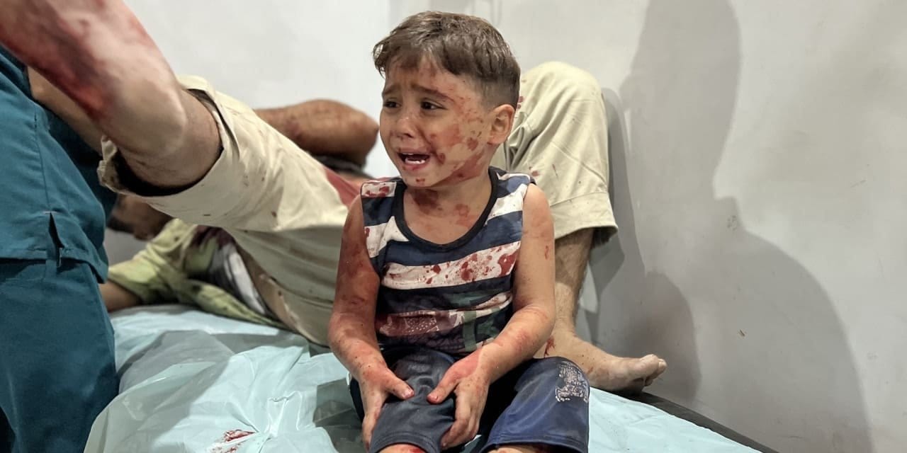 İsrail’in abluka uyguladığı Gazze Şeridi’nde açlıktan ölenlerin sayısı artıyor