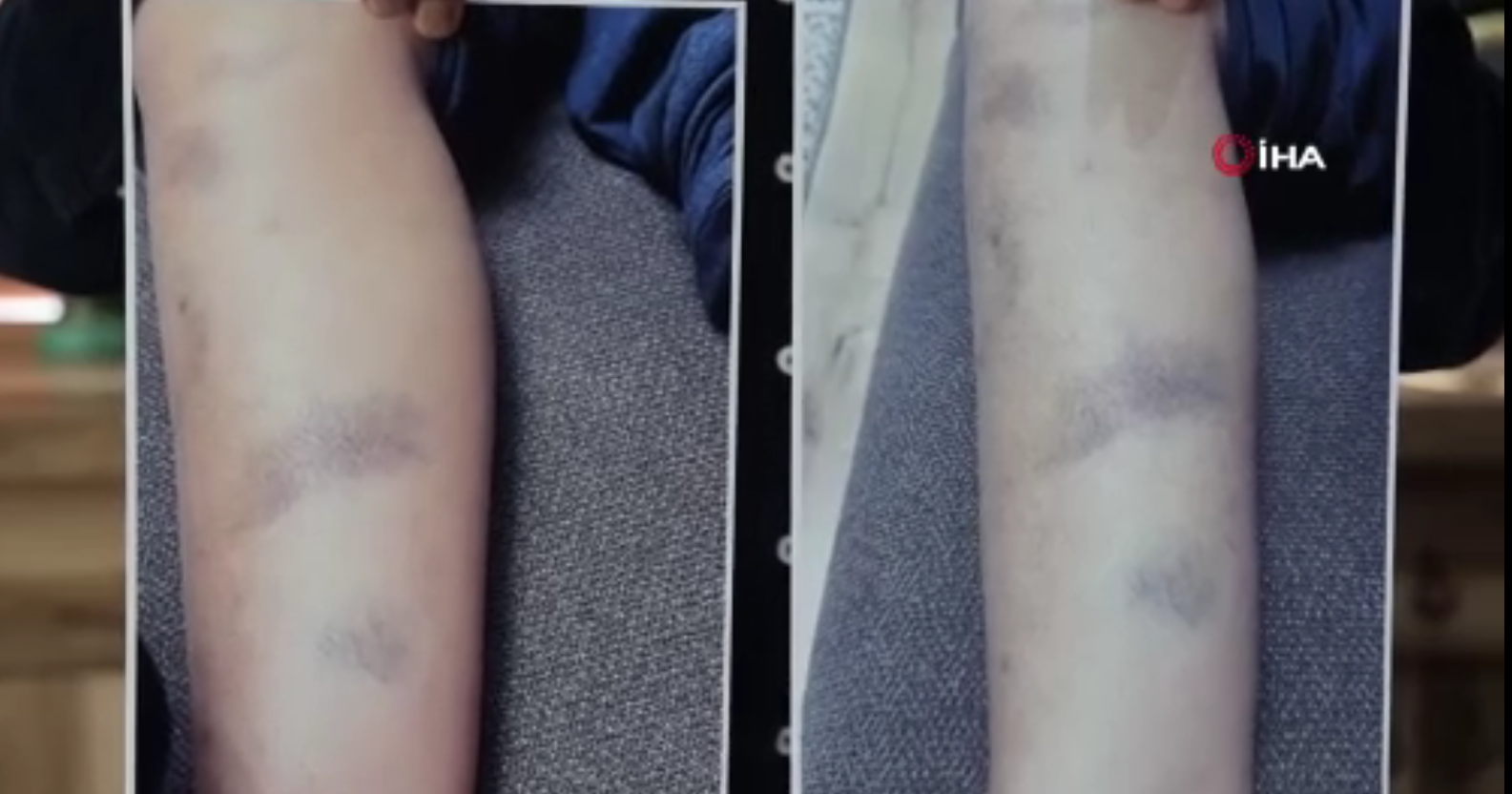 Diyarbakır’da özel okulda öğrenciye dayak iddiasına soruşturma